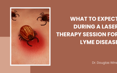 What to Expect During a Laser Therapy Session for Lyme Disease